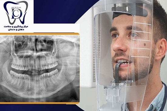 گرامیداشت روز رادیولوژی دندان‌پزشکی 