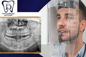 گرامیداشت روز رادیولوژی دندان‌پزشکی؛ نگاهی نو به تشخیص دقیق و مراقبت ایمن از بیماران