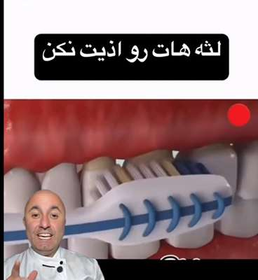 لثه هاتو اذیت نکن