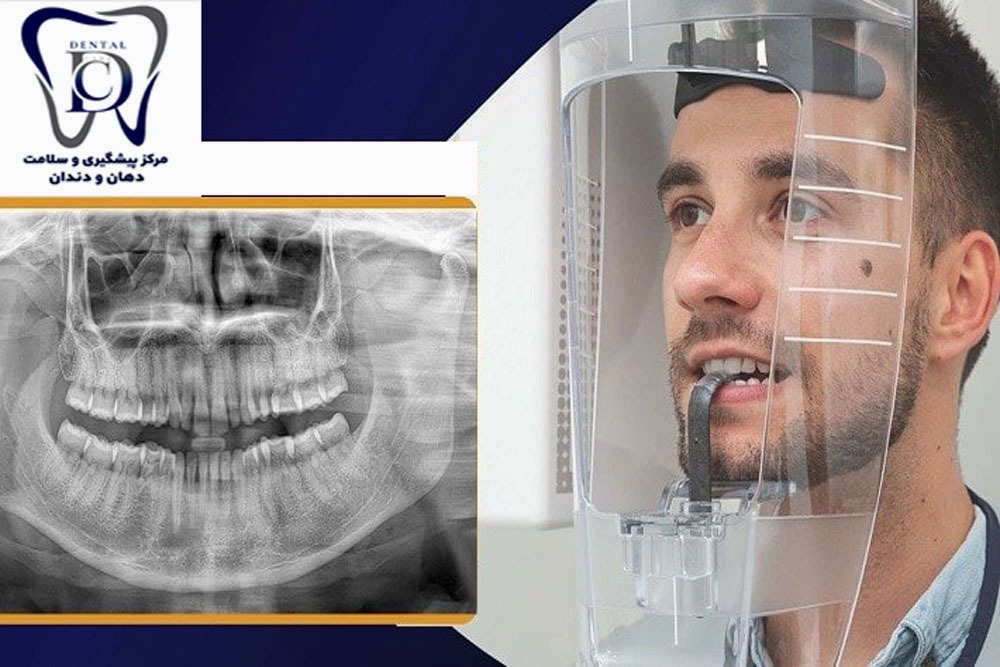 گرامیداشت روز رادیولوژی دندان‌پزشکی؛ نگاهی نو به تشخیص دقیق و مراقبت ایمن از بیماران